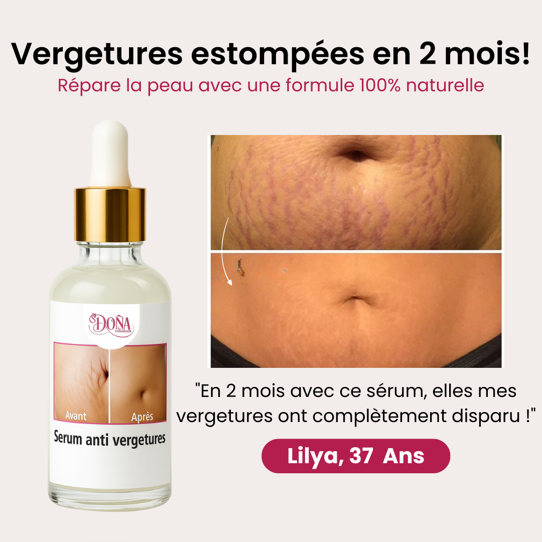 LADONA™ : Retrouve une peau uniforme sans vergetures !