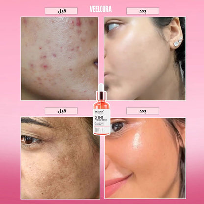 سيروم 5 في 1 لتفتيح البشرة والتخلص من التجاعيد، التصبغات و البقع الداكنة