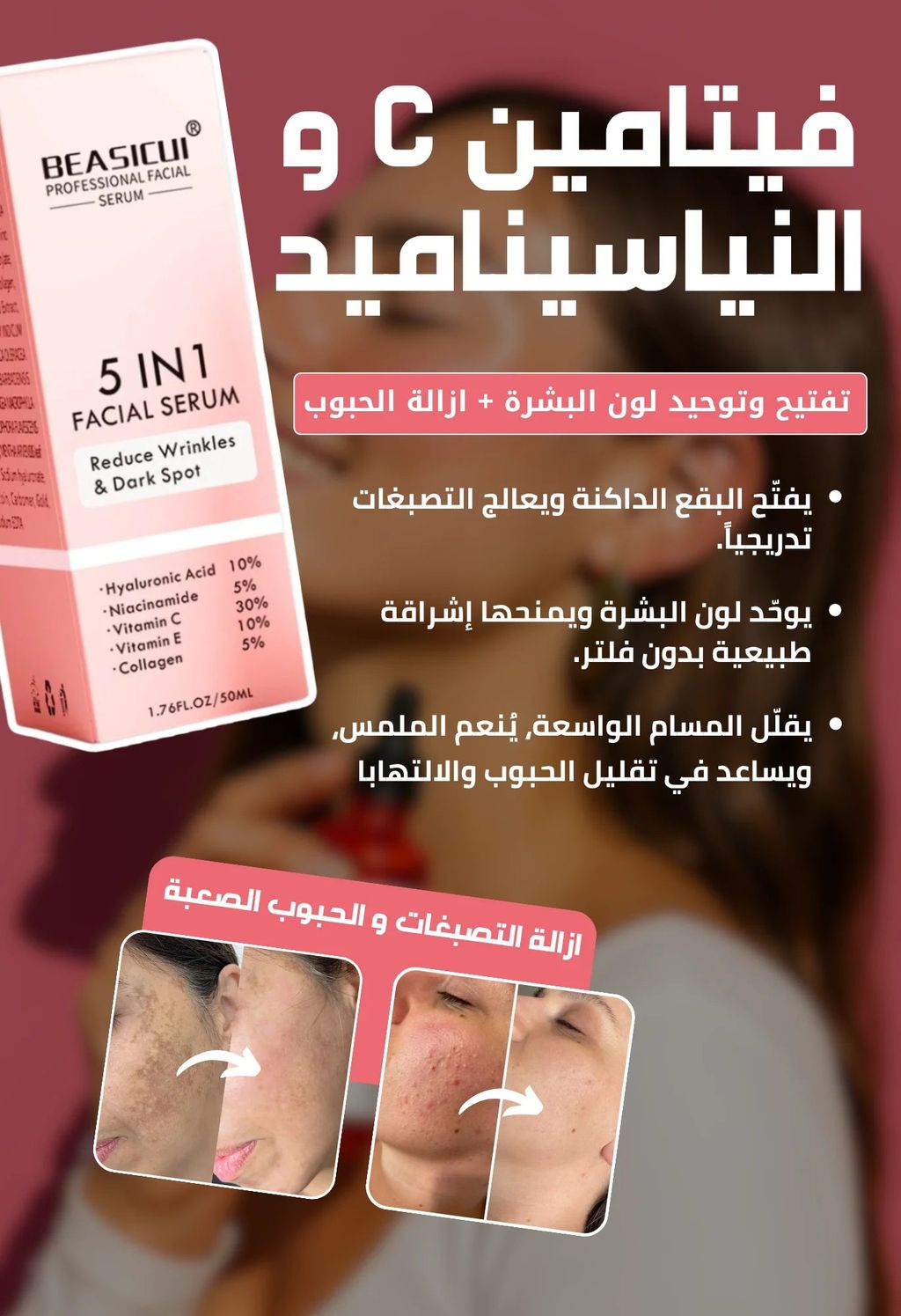 سيروم 5 في 1 لتفتيح البشرة والتخلص من التجاعيد، التصبغات و البقع الداكنة