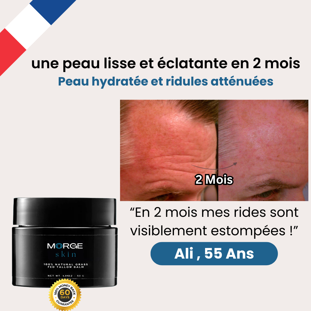 Morge™ : Efface les rides et rajeunissez vite