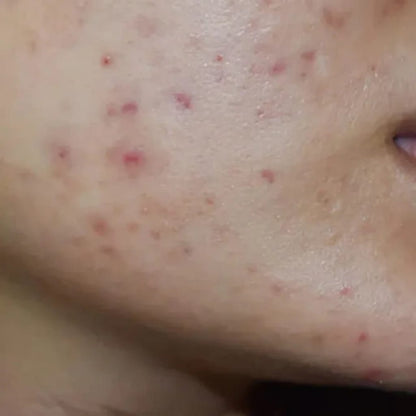 سيروم 5 في 1 لتفتيح البشرة والتخلص من التجاعيد، التصبغات و البقع الداكنة