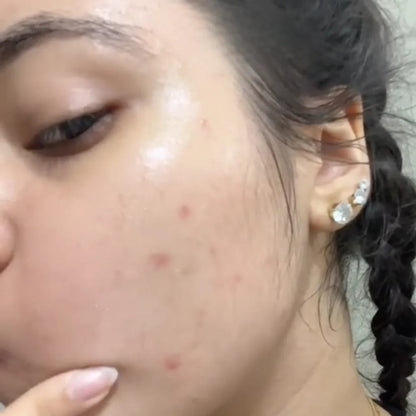 سيروم 5 في 1 لتفتيح البشرة والتخلص من التجاعيد، التصبغات و البقع الداكنة