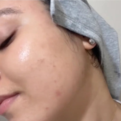 سيروم 5 في 1 لتفتيح البشرة والتخلص من التجاعيد، التصبغات و البقع الداكنة