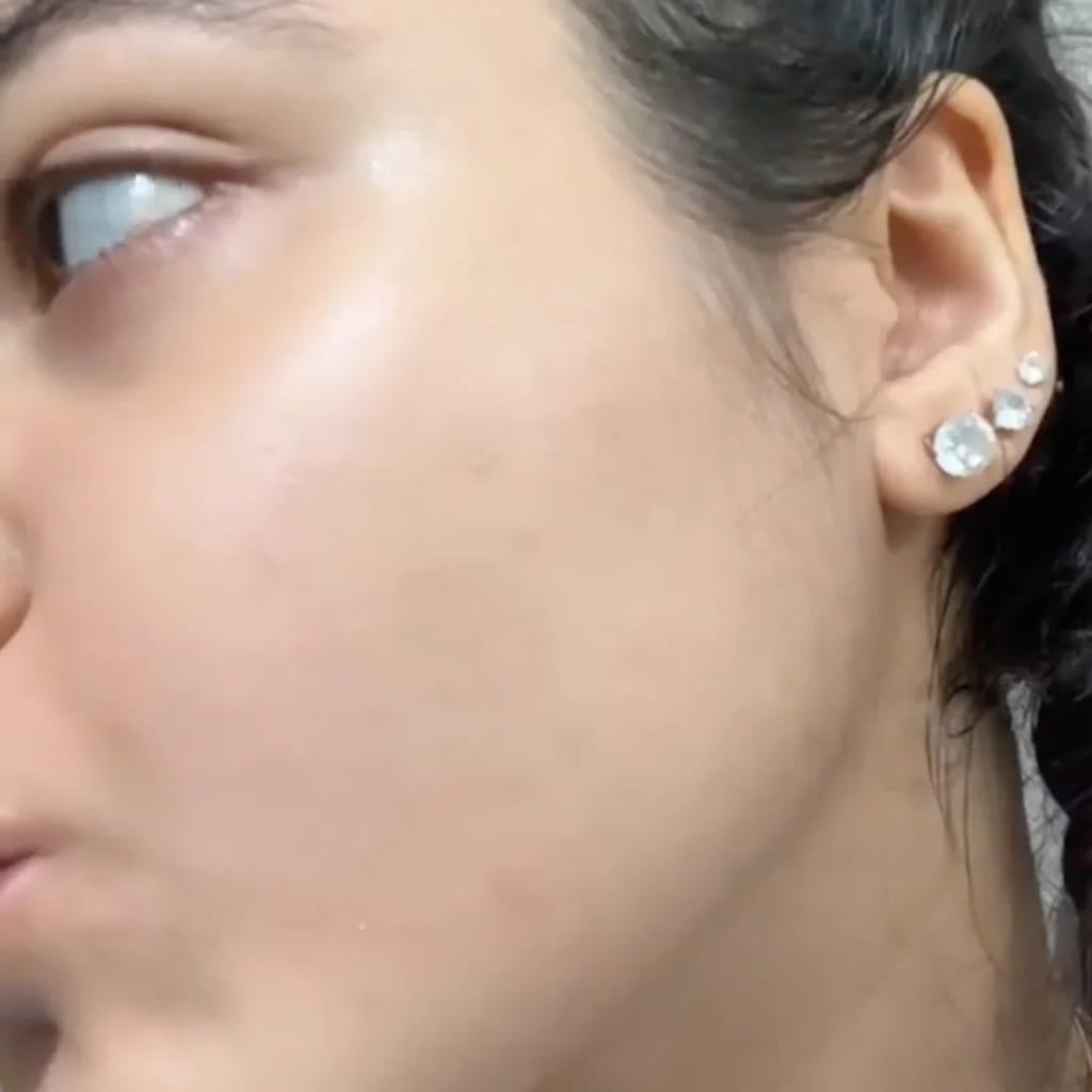 سيروم 5 في 1 لتفتيح البشرة والتخلص من التجاعيد، التصبغات و البقع الداكنة